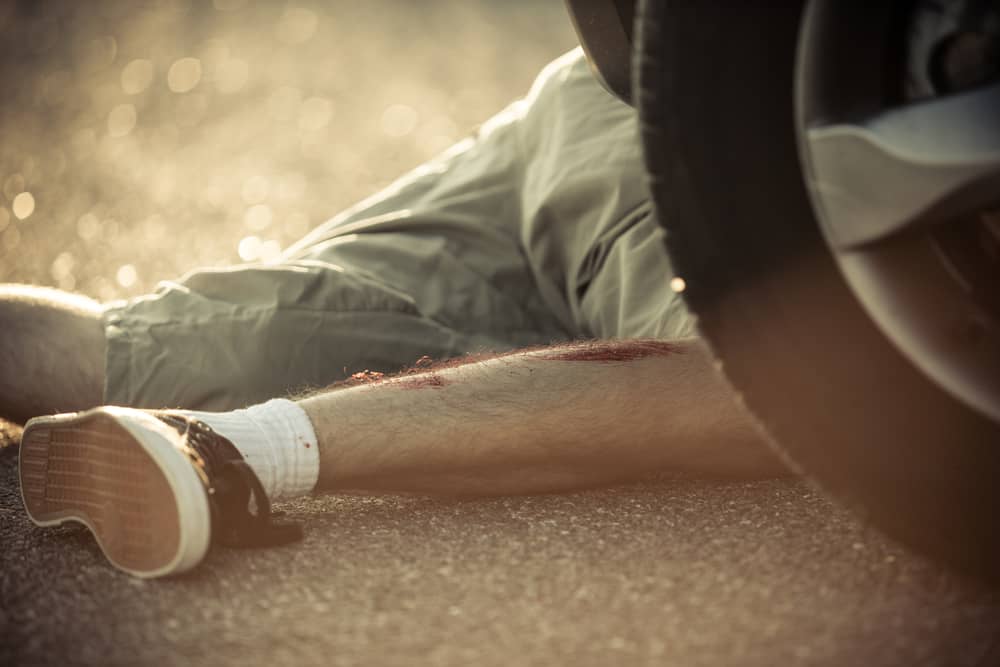 Photo of an Injured Man Hit by a Car