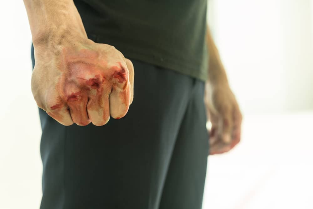 Aggressive Violent Man With Blood on His Fist
